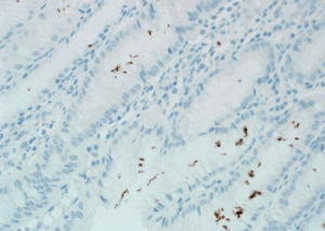 Image: Ventana anti-H. pylori (SP48) staining Helicobacter pylori organisms in gastric tissue. (Photo courtesy of PRNewsFoto/Ventana Medical Systems, Inc.).